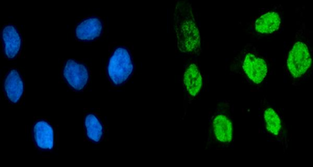 KHSRP Rabbit Polyclonal Antibody