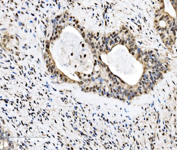 KHSRP Rabbit Polyclonal Antibody