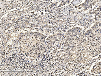 KHSRP Rabbit Polyclonal Antibody