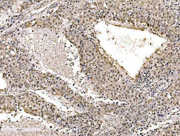 KHSRP Rabbit Polyclonal Antibody