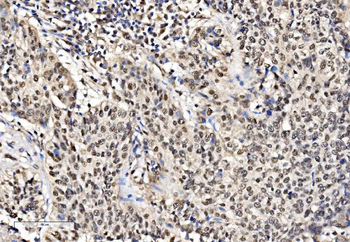 KHSRP Rabbit Polyclonal Antibody