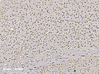 KHSRP Rabbit Polyclonal Antibody