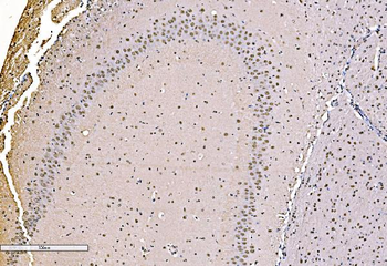 KHSRP Rabbit Polyclonal Antibody