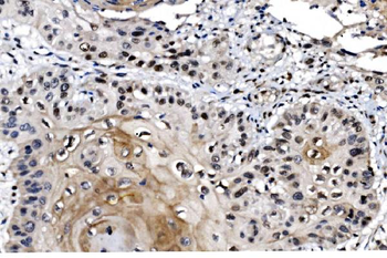 MAFF Rabbit Polyclonal Antibody