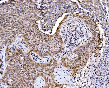 MAFF Rabbit Polyclonal Antibody