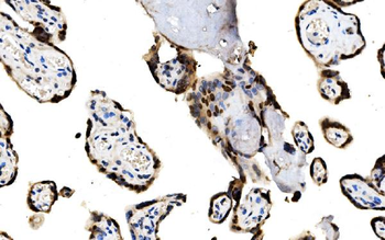 MAFF Rabbit Polyclonal Antibody