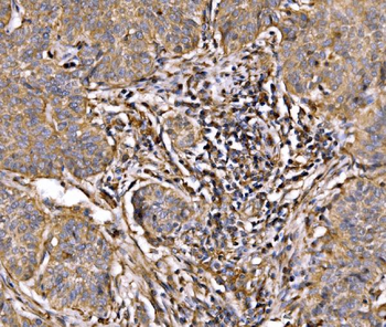 PI 3 Kinase p85 alpha/PIK3R1 Rabbit Polyclonal Antibody