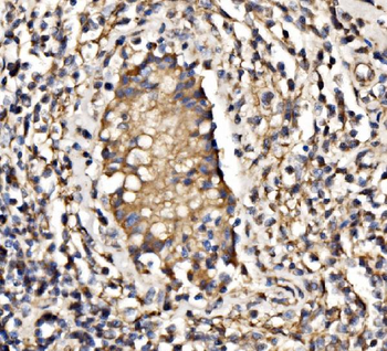 PI 3 Kinase p85 alpha/PIK3R1 Rabbit Polyclonal Antibody