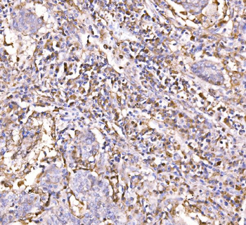 Epac1/RAPGEF3 Rabbit Polyclonal Antibody
