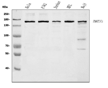 SMARCC1/BAF155 Rabbit Polyclonal Antibody