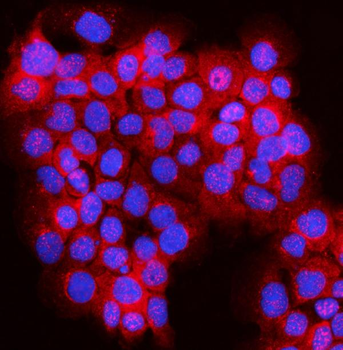 JLP/SPAG9 Rabbit Polyclonal Antibody