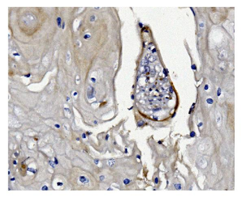 GSDMD Mouse Monoclonal Antibody