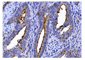 CD13/ANPEP Mouse Monoclonal Antibody