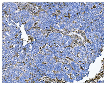 CD13/ANPEP Mouse Monoclonal Antibody