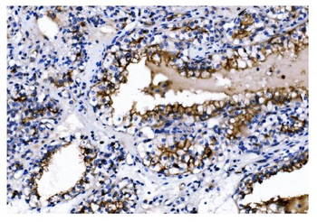 CD13/ANPEP Mouse Monoclonal Antibody