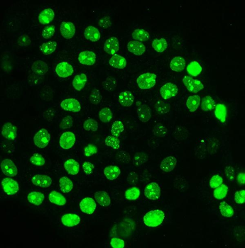 Ki67 Mouse Monoclonal Antibody