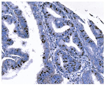 Ki67 Mouse Monoclonal Antibody