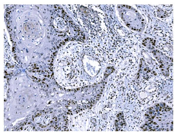 Ki67 Mouse Monoclonal Antibody