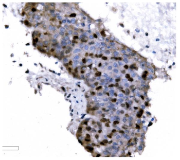 Ki67 Mouse Monoclonal Antibody