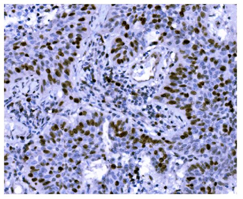 Ki67 Mouse Monoclonal Antibody