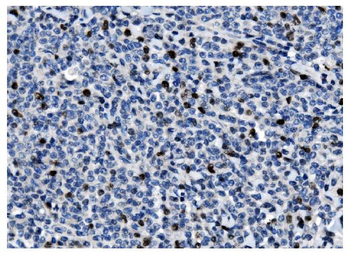 Ki67 Mouse Monoclonal Antibody