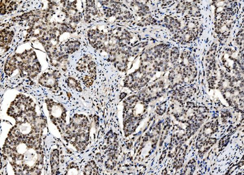 DBC-1/CCAR2/DBC Rabbit Polyclonal Antibody