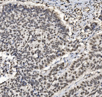 DBC-1/CCAR2/DBC Rabbit Polyclonal Antibody