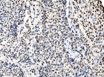 DBC-1/CCAR2/DBC Rabbit Polyclonal Antibody