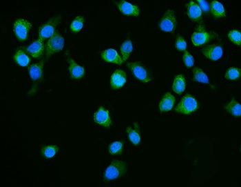 Dicer/DICER1 Rabbit Polyclonal Antibody