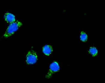 DLAT Rabbit Polyclonal Antibody