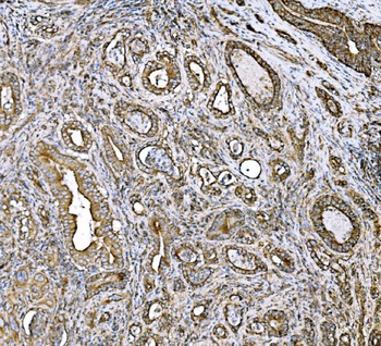 DLAT Rabbit Polyclonal Antibody