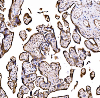 DLAT Rabbit Polyclonal Antibody