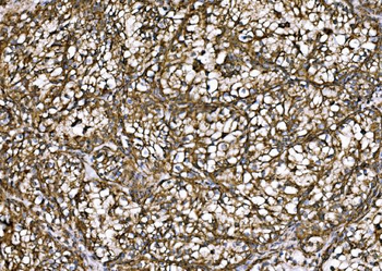 DLAT Rabbit Polyclonal Antibody