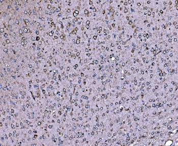 DLAT Rabbit Polyclonal Antibody