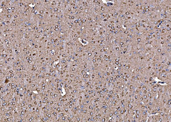 DLAT Rabbit Polyclonal Antibody