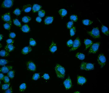 EDC4 Rabbit Polyclonal Antibody