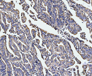 EDC4 Rabbit Polyclonal Antibody