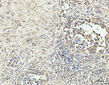 EDC4 Rabbit Polyclonal Antibody