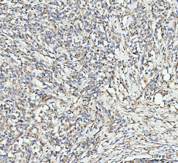 EDC4 Rabbit Polyclonal Antibody