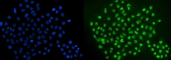 ERG Rabbit Polyclonal Antibody