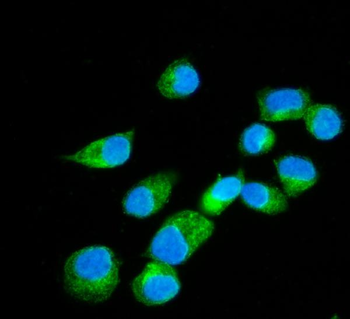 Erlin-2/ERLIN2 Rabbit Polyclonal Antibody