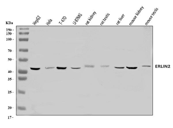 Erlin-2/ERLIN2 Rabbit Polyclonal Antibody