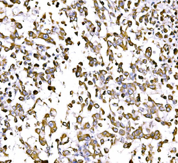 GGA3 Rabbit Polyclonal Antibody
