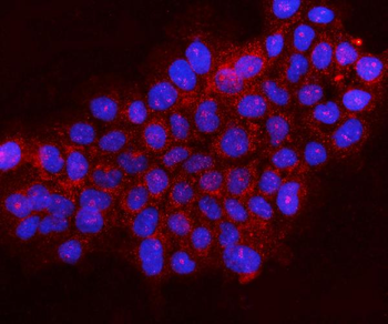 Gephyrin/GPHN Rabbit Polyclonal Antibody