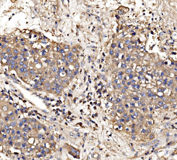 Gephyrin/GPHN Rabbit Polyclonal Antibody