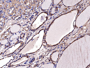 Gephyrin/GPHN Rabbit Polyclonal Antibody