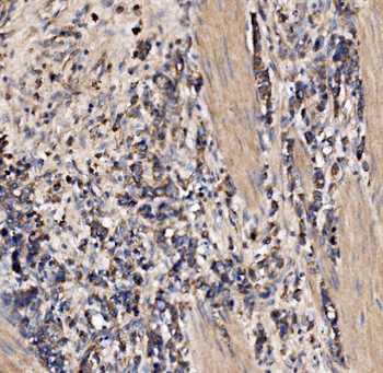 Gephyrin/GPHN Rabbit Polyclonal Antibody