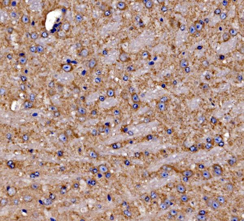 Gephyrin/GPHN Rabbit Polyclonal Antibody