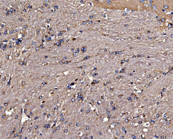 Gephyrin/GPHN Rabbit Polyclonal Antibody