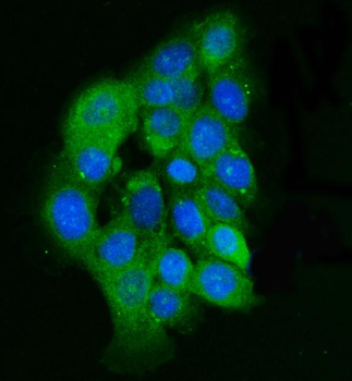 Integrin linked ILK Rabbit Polyclonal Antibody
